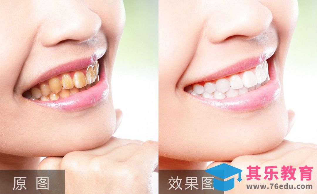 PS-牙齿美白精修[虎课网手机摄影入门视频教程][MP4产品摄影教程全集 ]-第1张图片-我要自学网