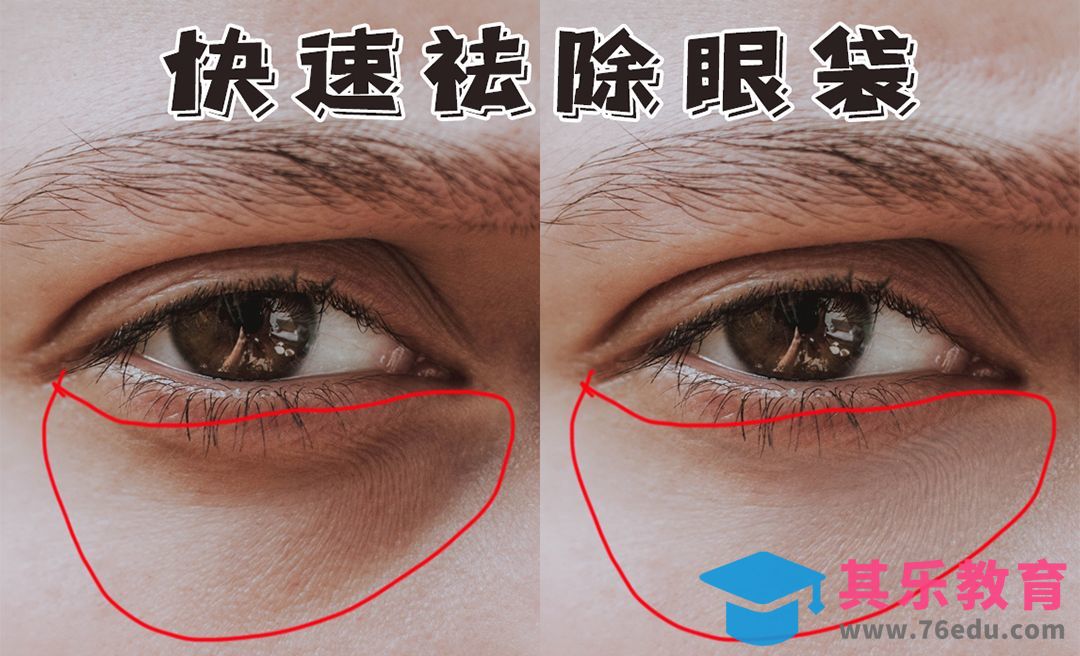 PS-快速祛除眼袋[虎课网手机摄影入门视频教程][MP4产品摄影教程全集 ]-第1张图片-我要自学网