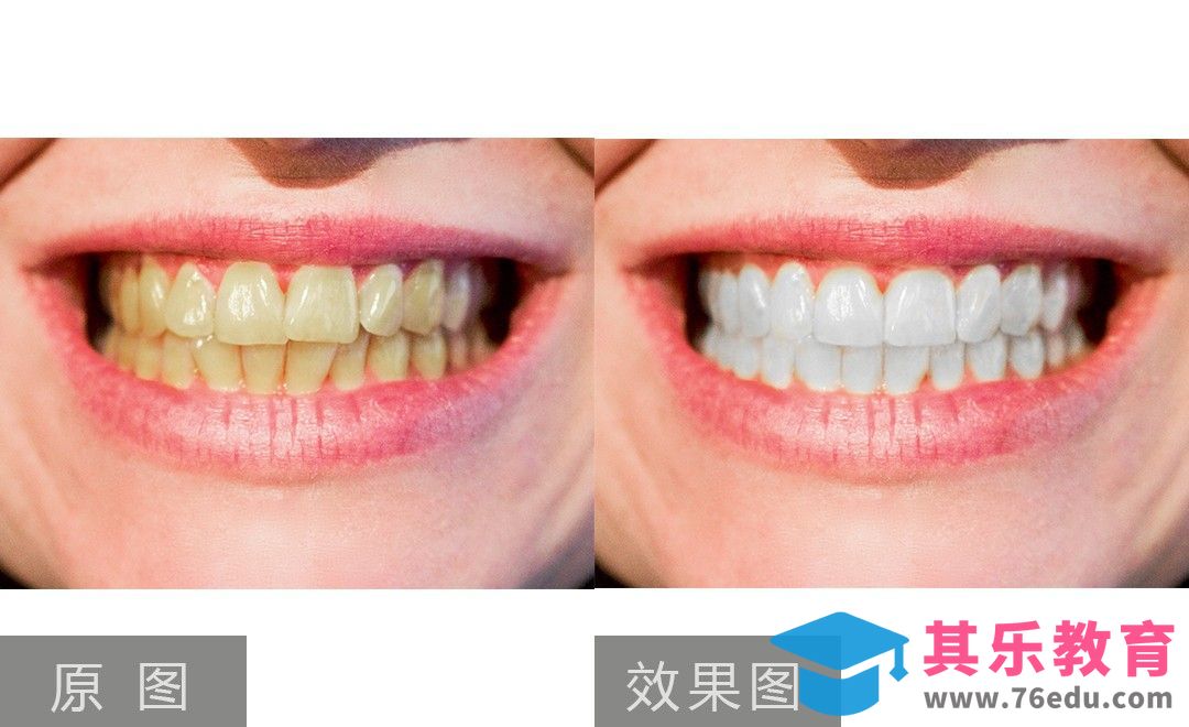 PS-牙齿矫正和美白[虎课网手机摄影入门视频教程][MP4产品摄影教程全集 ]-第1张图片-我要自学网