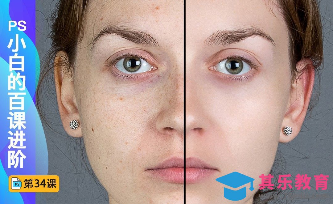 百课进阶34-皮肤祛斑祛痘[虎课网最新视频教程][免费高清MP4教程全集 ]-第1张图片-我要自学网
